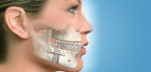 Chirurgien dentaire ou maxillo-facial