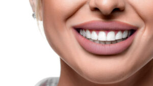 Prix hollywood smile en Tunisie