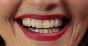 Est-il normal de perdre ses dents naturelles en vieillissant ?